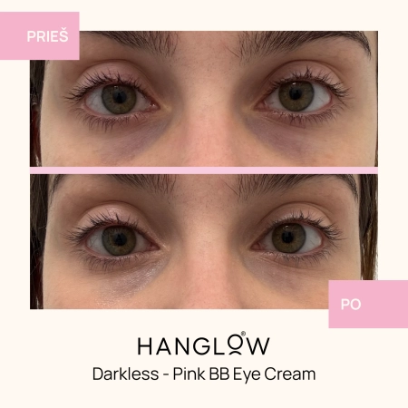 HanGlow - Darkless - Pink BB Eye Cream - Kremas - Maskuoklis Paakiams - 15ml