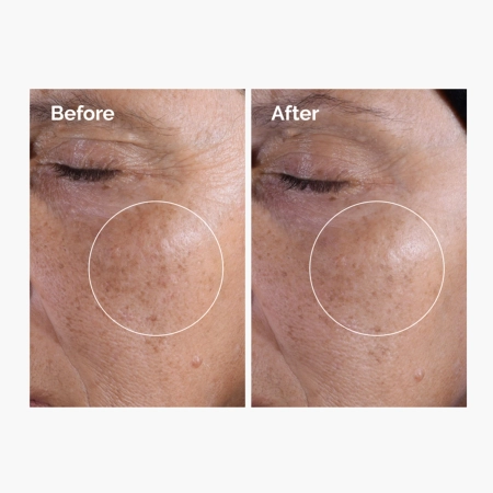 The Ordinary - Glycolic Acid 7% Exfoliating Toner - Tonikas su 7% Glikolio Rūgštimi - 240ml
