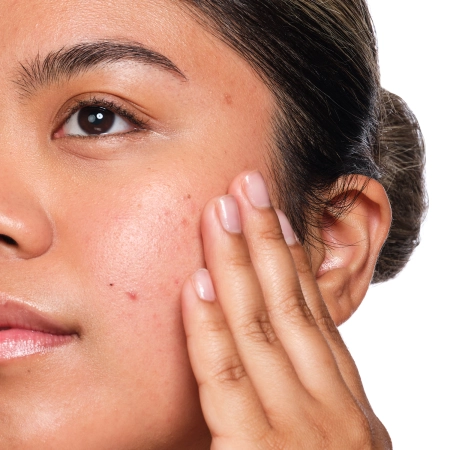 The Ordinary - Salicylic Acid 2% Solution – Serumas su Salicilo Rūgštimi – 30 ml