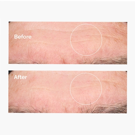 The Ordinary - Hyaluronic Acid 2% + B5 – Drėkinamasis Serumas su 2 % Hialurono Rūgštimi ir Vitaminu B5 – 60 ml