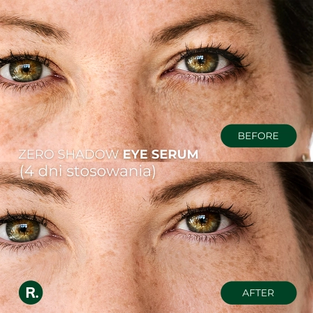 Ralls - Zero Shadow Eye Serum - Paakių Serumas - 20ml