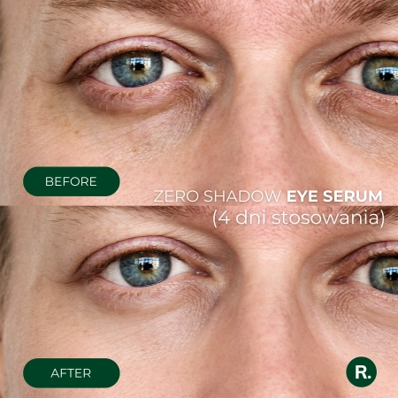 Ralls - Zero Shadow Eye Serum - Paakių Serumas - 20ml