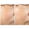 The Ordinary - Rice Lipids + Ectoin Microemulsion - Mikroemulsija su Ryžių Lipidais ir Ektoinu - 60ml